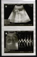 Highlight for album: Baby Sonogram