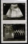 Sonogram 4.jpg
