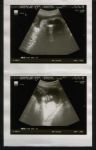 Sonogram 5.jpg